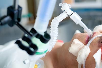 Prevención de NAV es una de las soluciones que ofrecemos de prevención de infecciones